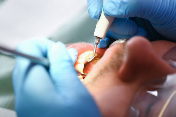 Best Emergency Dental Care for Sports Injuries in Camp Point, IL